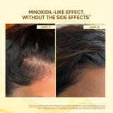 Moonlight Growth™ Scalp Serum