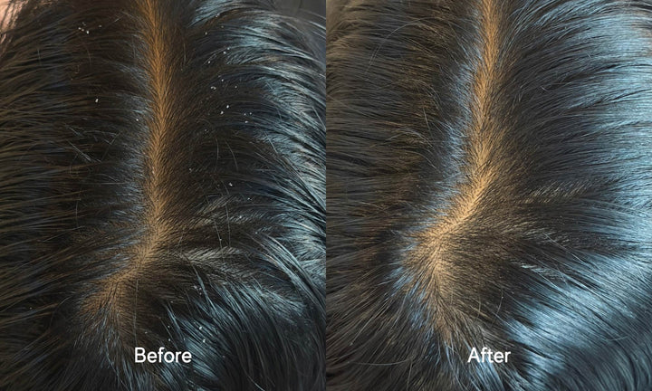 A side-by-side close-up comparison of a person's dark hair part line, labeled 'Before' on the left and 'After' on the right, showing clearer separation and healthier-looking hair.